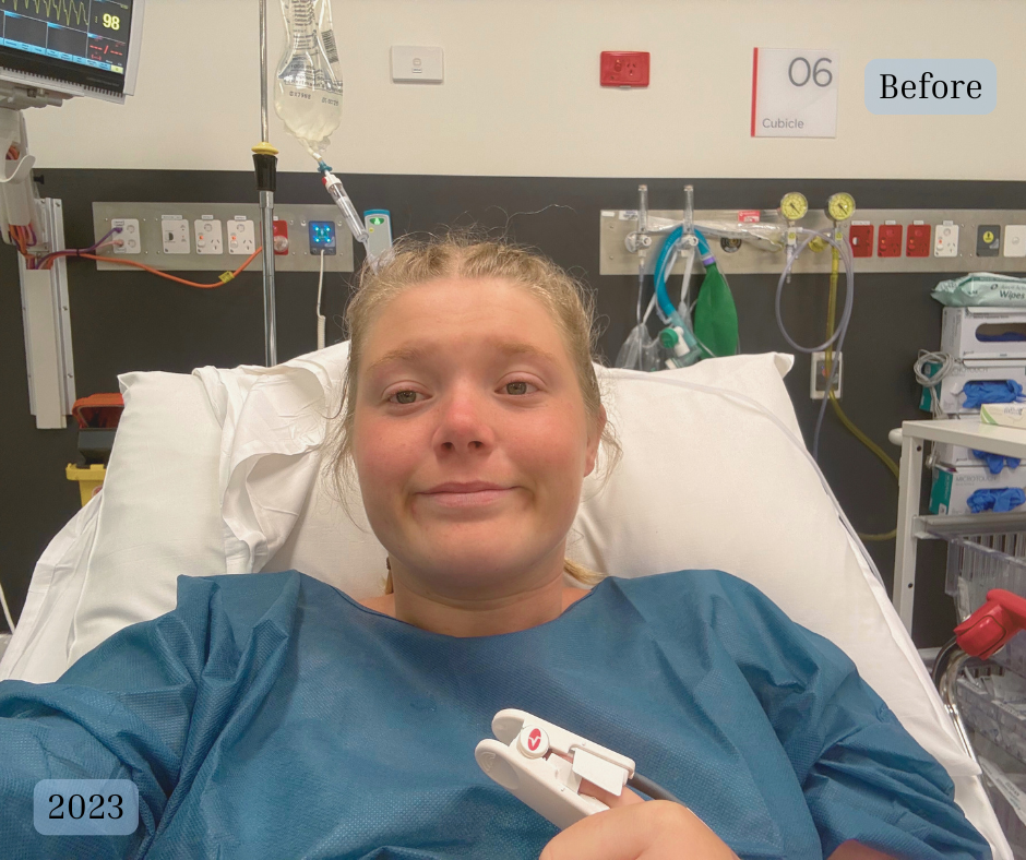 Hospital bed 2023